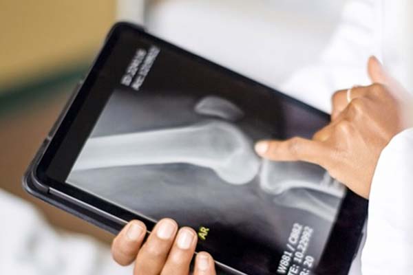 Transforming The Implant Bill-Only Process featured image